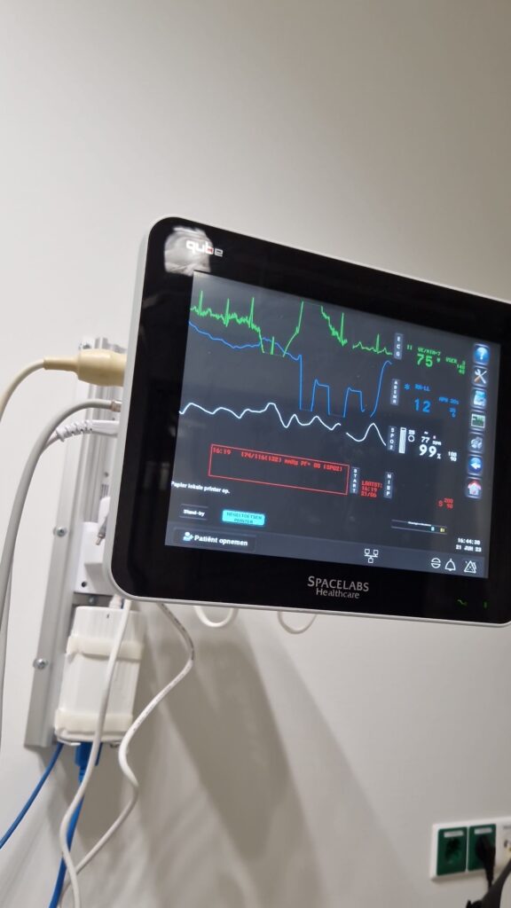 Monitoren van diverse functies van mijn lichaam